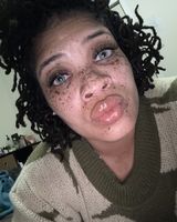 Freckles89